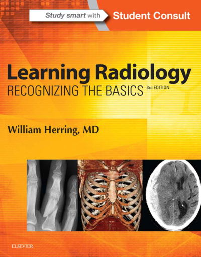 Learning Radiology: Recognizing The Basics / William Herring Limon Fotokopi